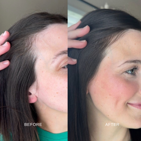 100% NATURAL HAIR GROWTH ELIXIR