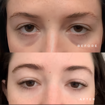 Eye Serum