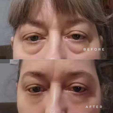 Eye Serum