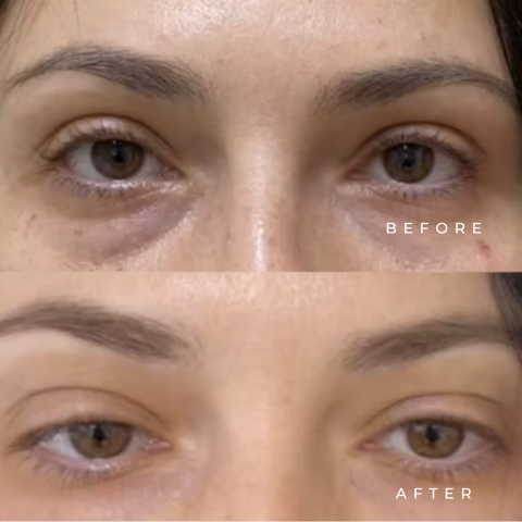 Eye Serum