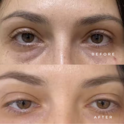 Eye Serum