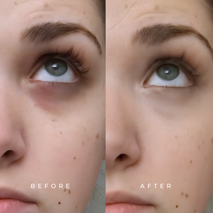Eye Serum