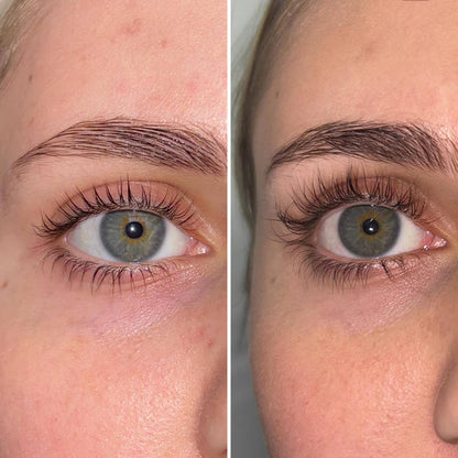 WIMPERNSERUM